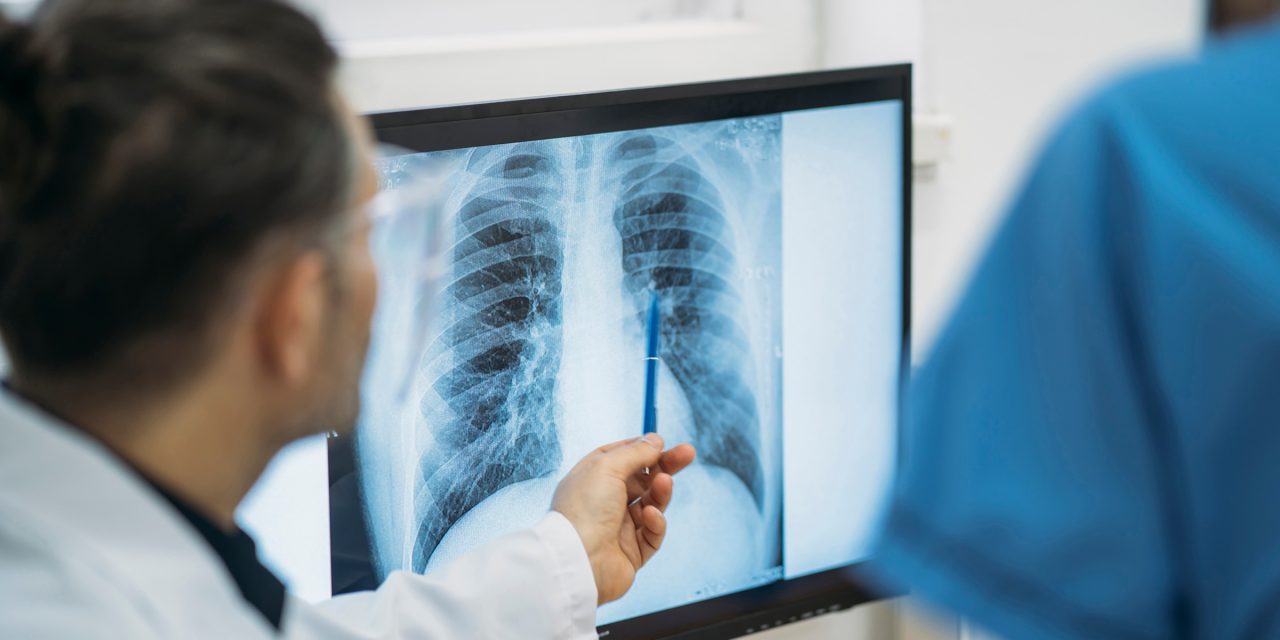 不同類型肺小結節：應區別對待