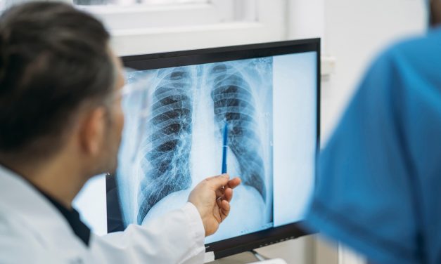 不同類型肺小結節：應區別對待