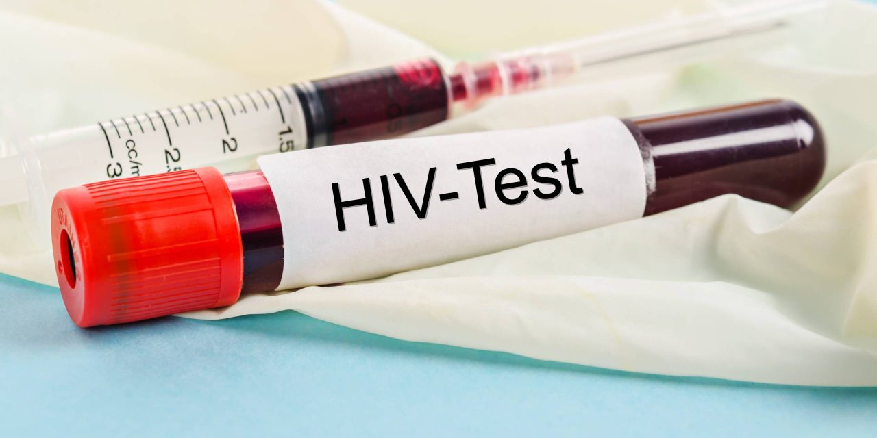 主動檢測HIV，為愛滋病防控添磚加瓦