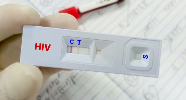 愛滋病自測試紙帶來的煩惱