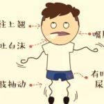 患了 “類風關” 且看中醫巧調治