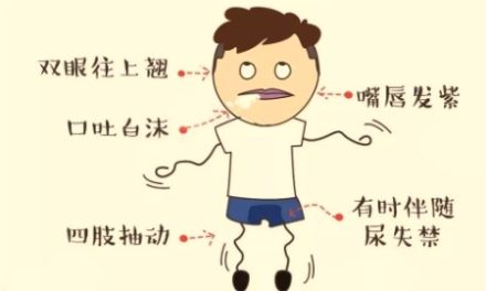 患了 “類風關” 且看中醫巧調治